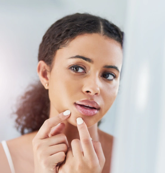 Woman touching a cold sore on her lip before receiving professional cold sore treatment at South Arlington Smiles in Arlington, TX.